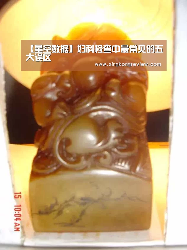 【星空数据】妇科检查中最常见的五大误区(图1) 星空数据